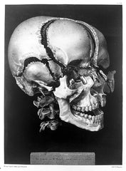 31 anatomie